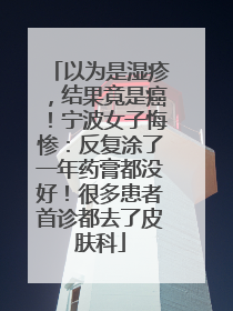 以为是湿疹，结果竟是癌！宁波女子悔惨：反复涂了一年药膏都没好！很多患者首诊都去了皮肤科